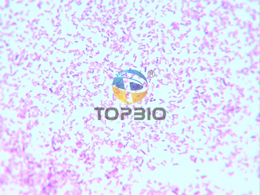 ���c��ϣ�Ͼ��@΢�R�R�z��Ƭ